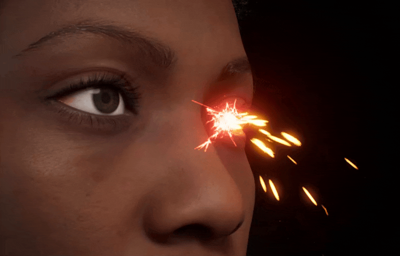 Sparks