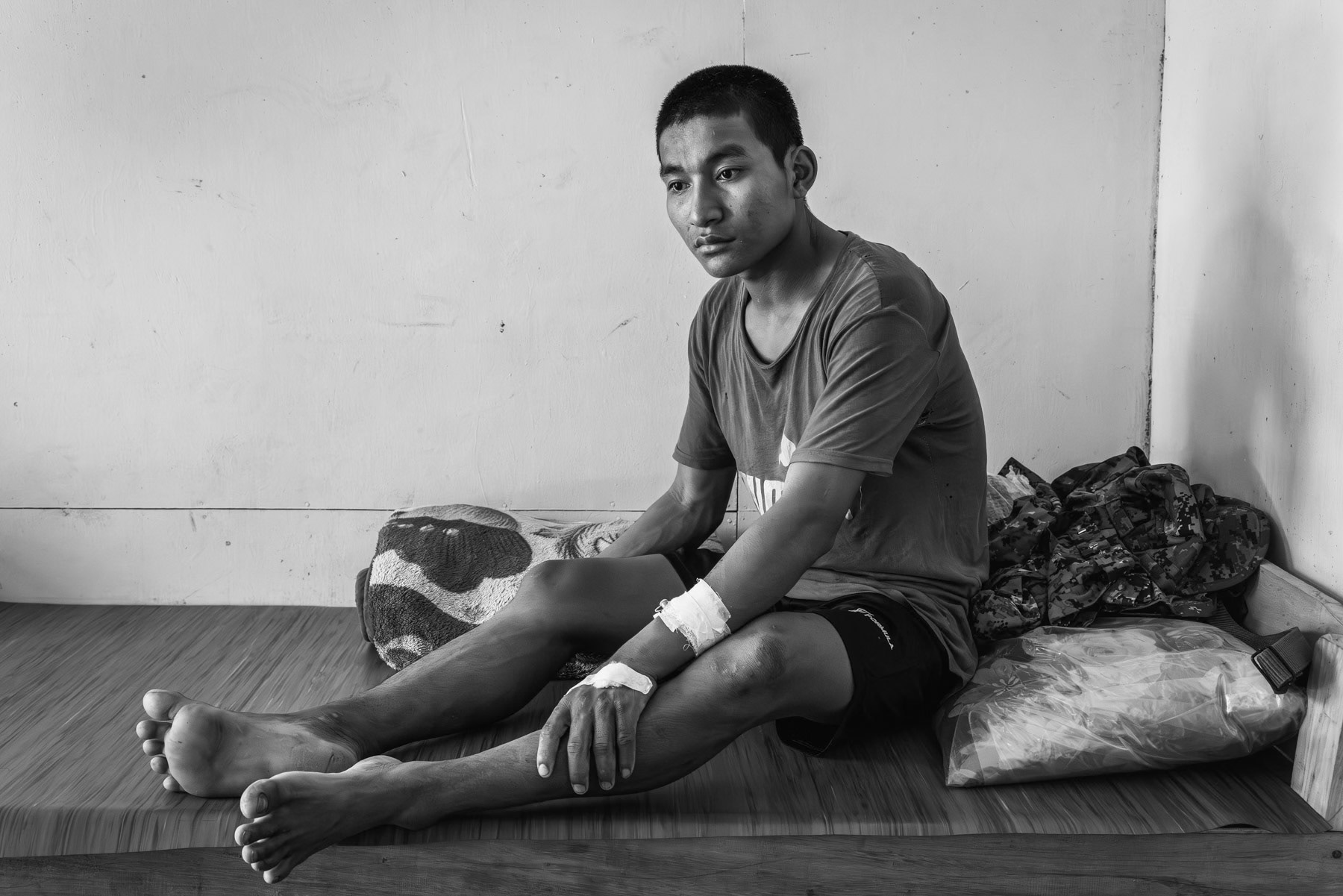 Soldier of the Chin National Army (CNA) recovering at the military hospital in Camp Victoria, the HQ of the CNA. Chin State, Myanmar, April 2024