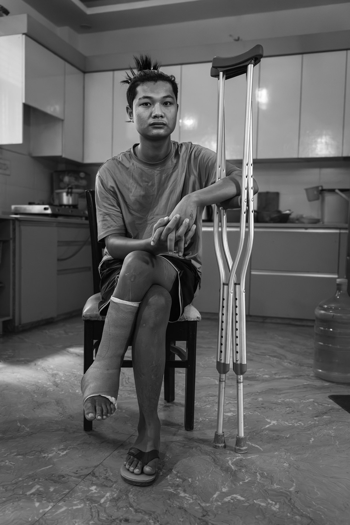 Zung Uktung, 18 years old from Thangtlang was part of the Chin Defence Forces when he stepped on a landmine in November 2023. The relative proximity of a medical facility and first aid on the frontline contributed to his leg being saved and avoid amputation. He is now in New Delhi to have recontructive surgery on his heel and having titanium plates fixed. After recovering he will return to his unit until the revolution overthrows the military dictatorship. Chin safe house in New Delhi, India, April 2024