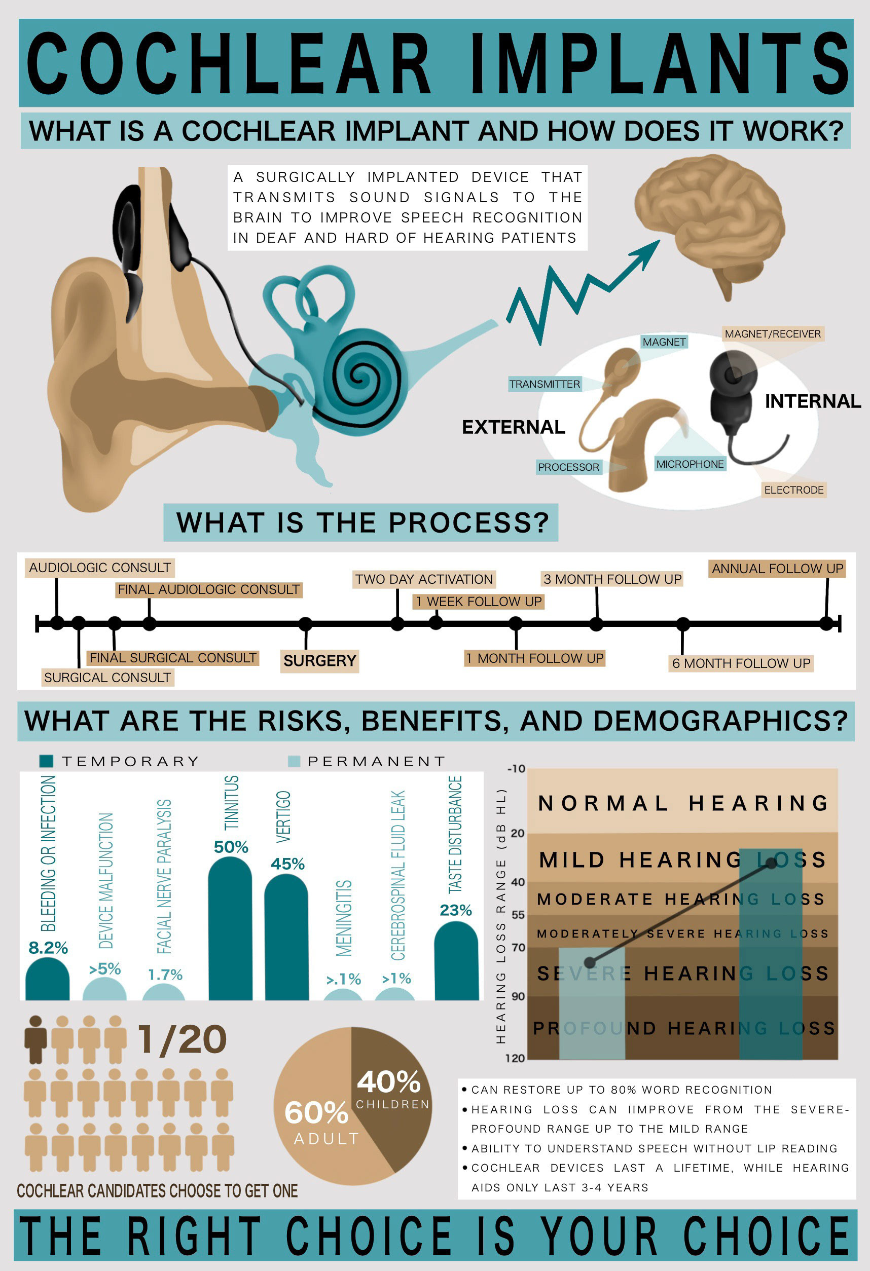 Cochlear Implant Infographic (2022)