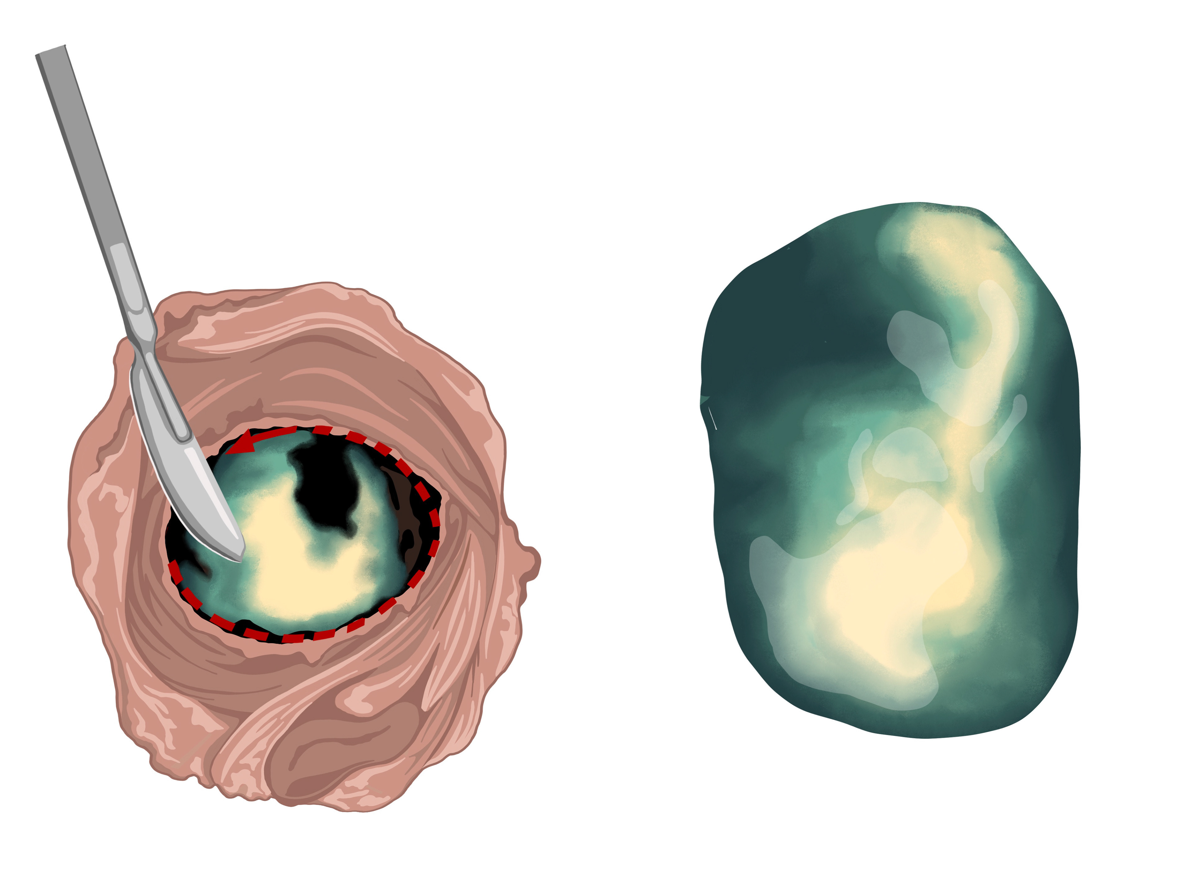 UMMNH Cow Eye Dissection Commission