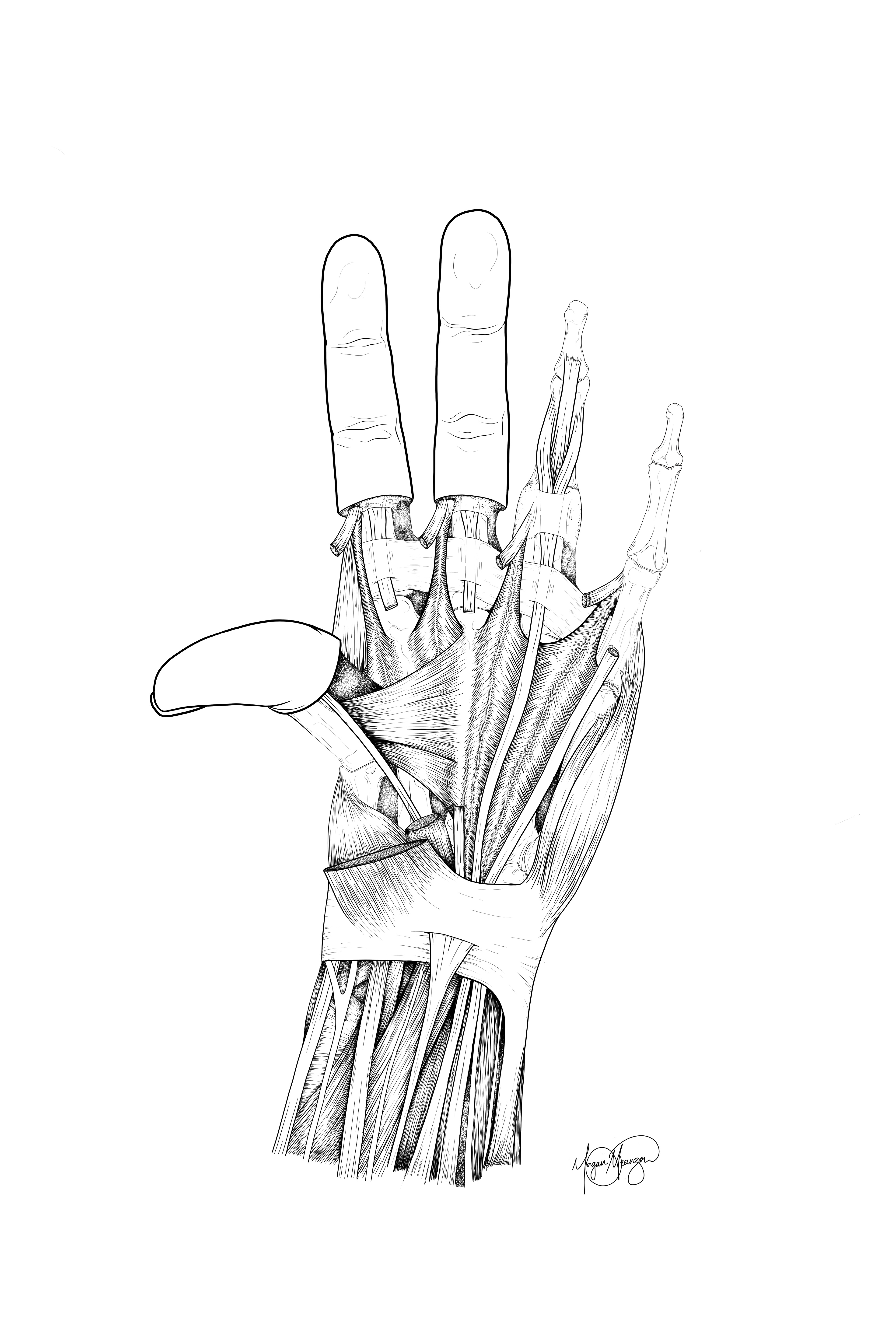 Hypermobile Dissection of the Hand (Photoshop, 2025)