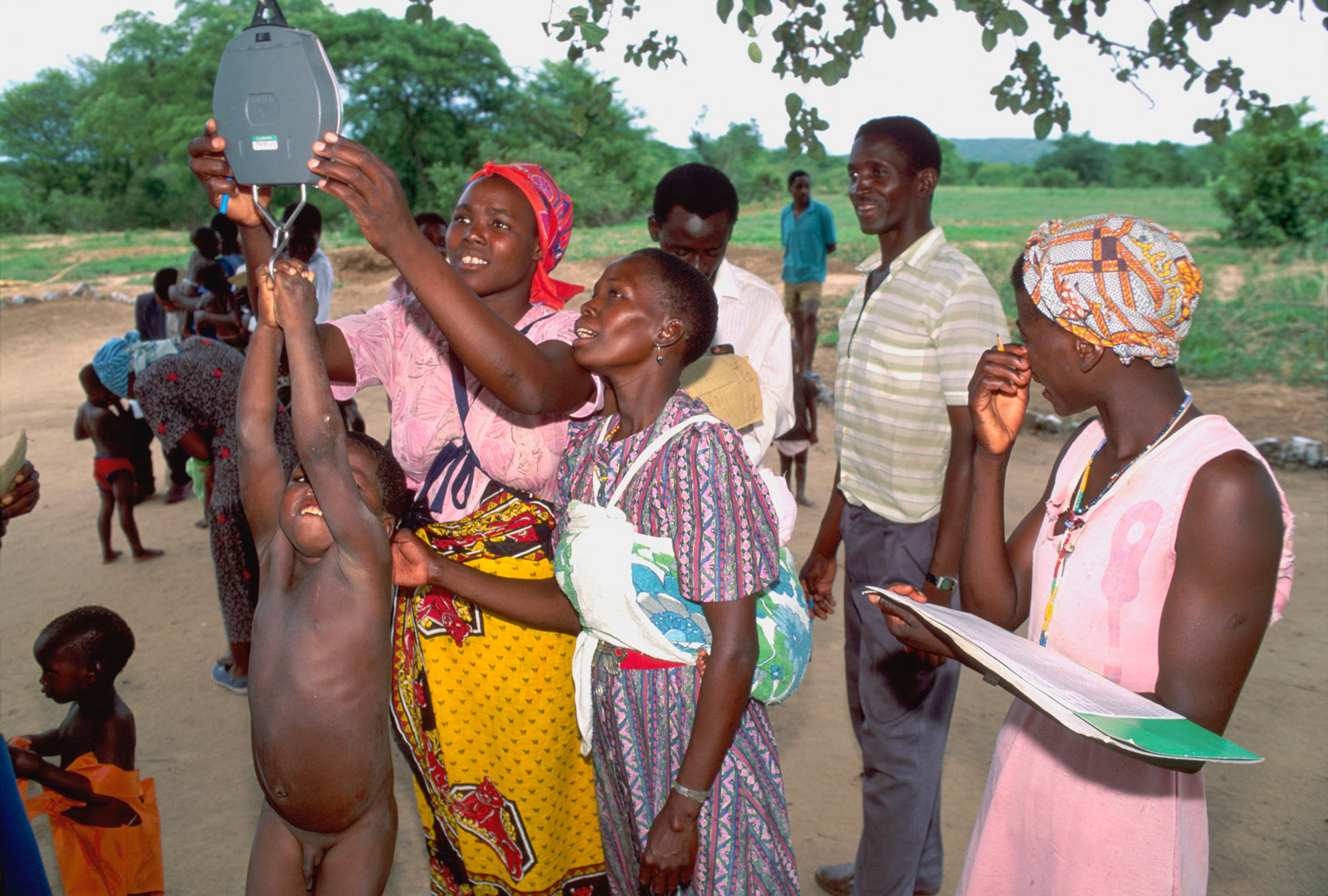 Weighing a child at an open-air rural health clinic. Zimbabwe