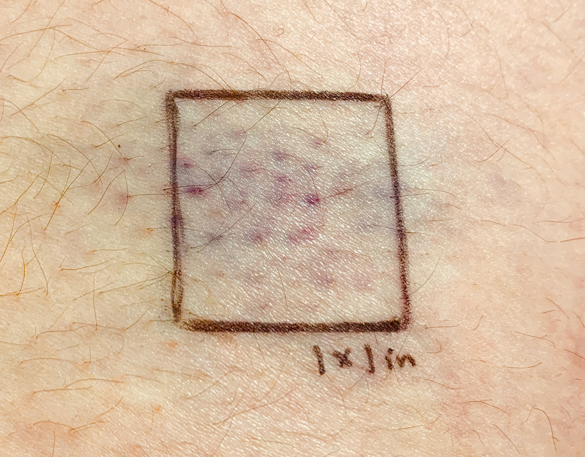 1x1" mark