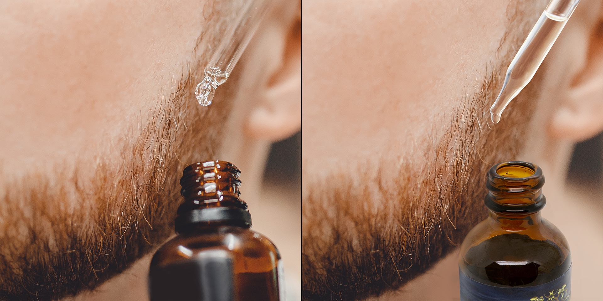 Bottle with beard oil drops, oil drops from eyedropper on the beard of a man close up. Before and after image.