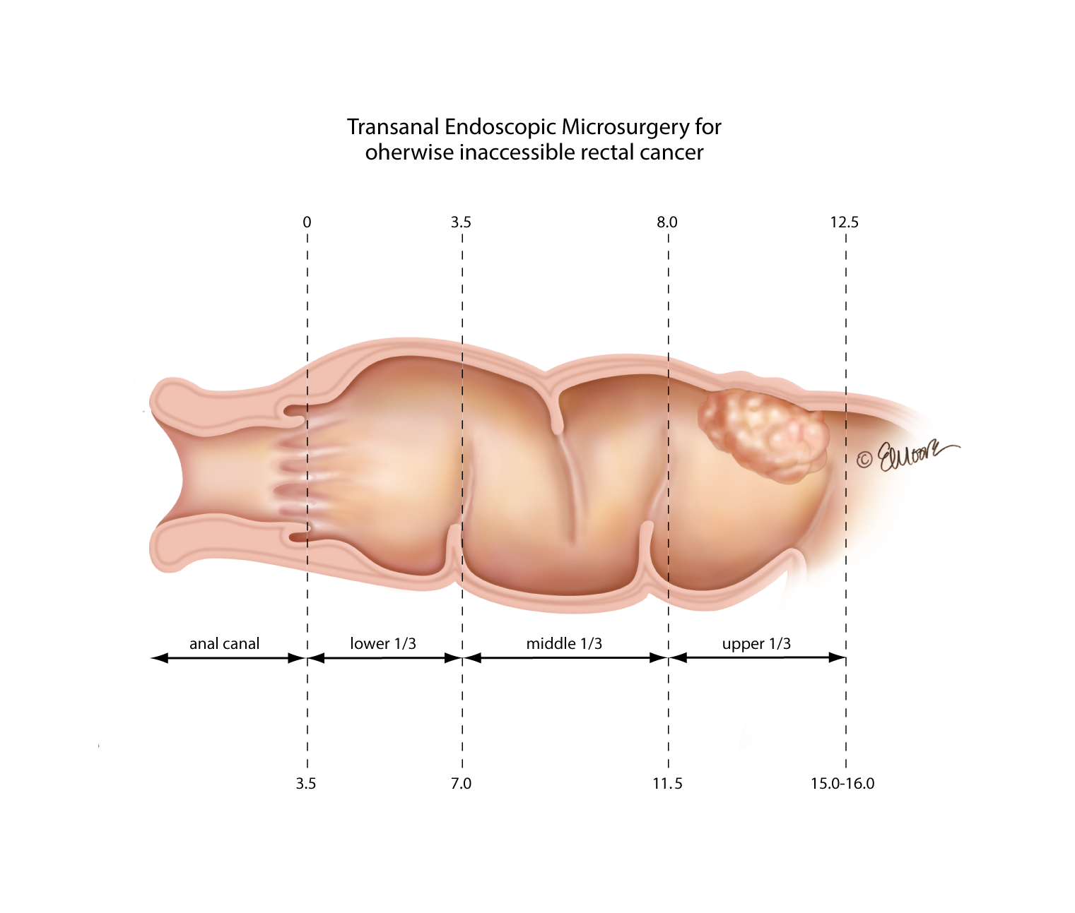 ©2024 Erin E. Moore, MA. This artwork is protected under international copyright laws and agreements. No part of this artwork may be reproduced, stored in a retrieval system, or transmitted in any form or by any means, electronic, mechanical, photocopying, recording, or otherwise, without the prior written permission of the artist.    
