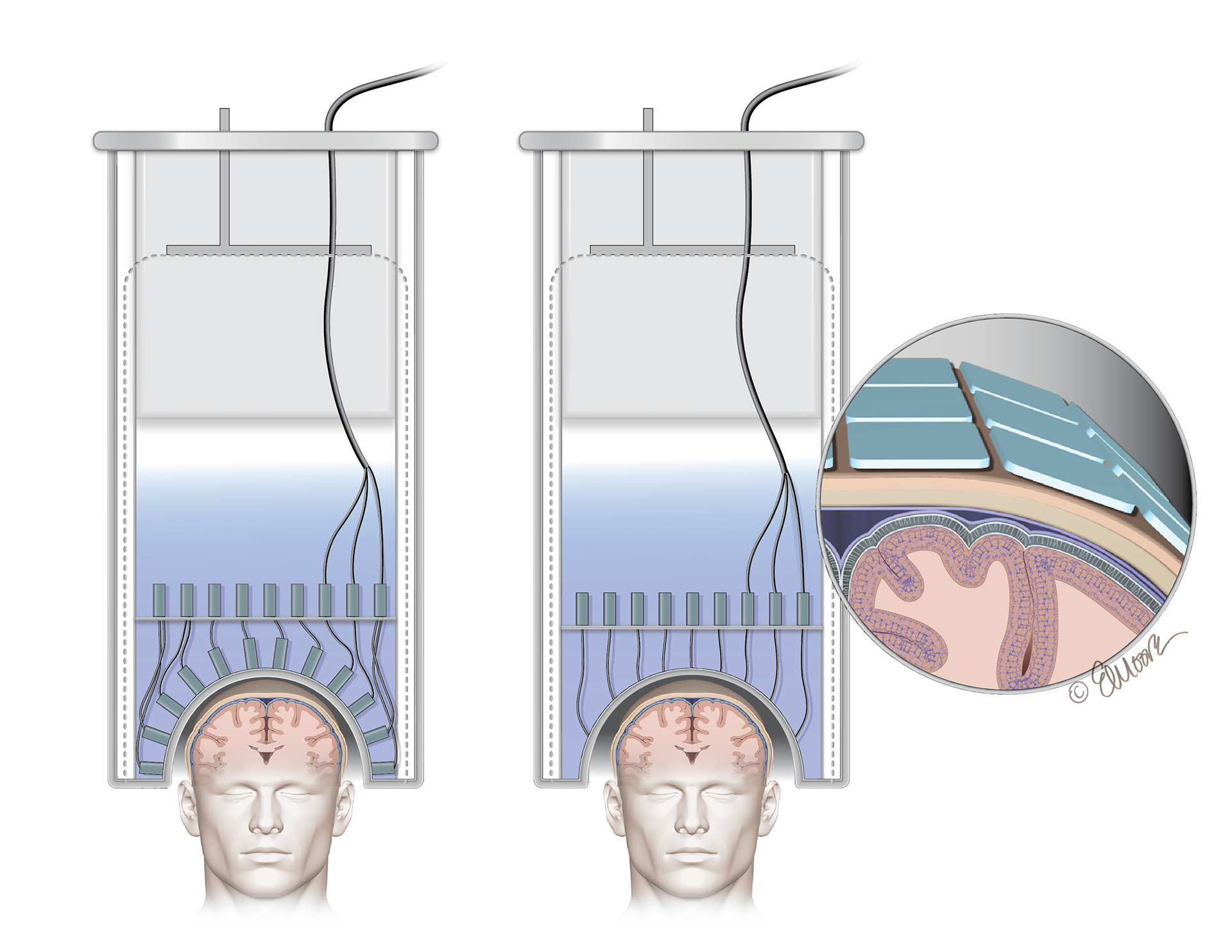 ©2023 Erin E. Moore, MA. This artwork is protected under international copyright laws and agreements. No part of this artwork may be reproduced, stored in a retrieval system, or transmitted in any form or by any means, electronic, mechanical, photocopying, recording, or otherwise, without the prior written permission of the artist.    