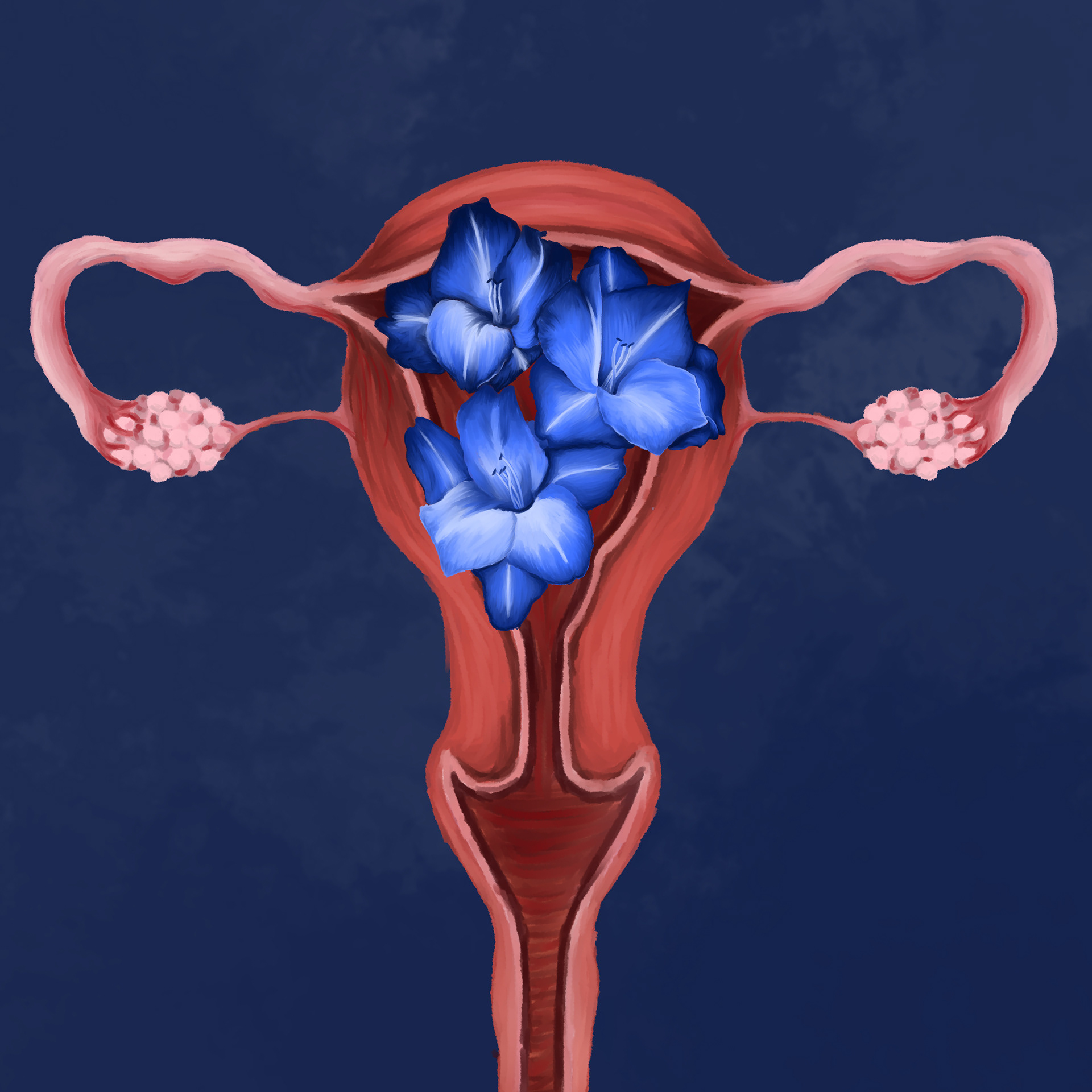 A uterus with blooming gladiolus.