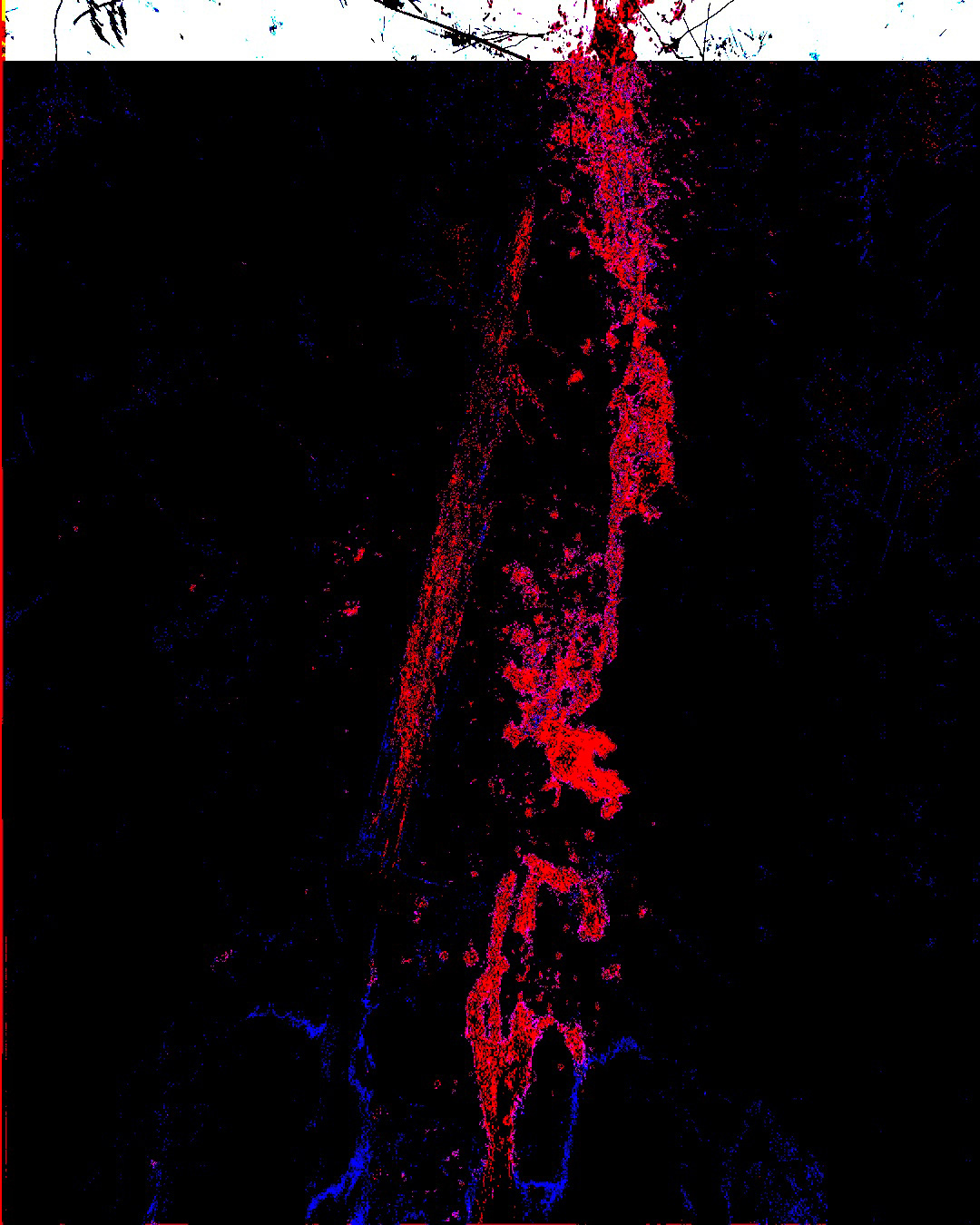 HEMORRHAGE